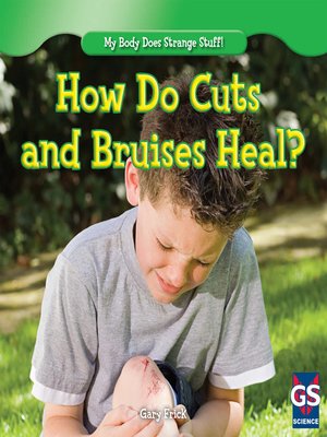 cover image of How Do Cuts and Bruises Heal?